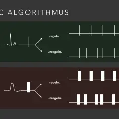 ERC Algorithmus: Schmale und breite QRS-Komplexe, die zu regelmäßigen oder unregelmäßigen Rhythmen führen. Diese Unterscheidung ist wichtig für die Behandlung von nicht defibrillierbare Rhythmen.