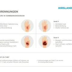 Verbrühungen werden nach ihrem **Verbrennung grad** eingestuft: Grad 1 (gerötete Haut), Grad 2 (Blasenbildung), Grad 3 (Hautfetzen) und Grad 4 (verkohlte Haut).