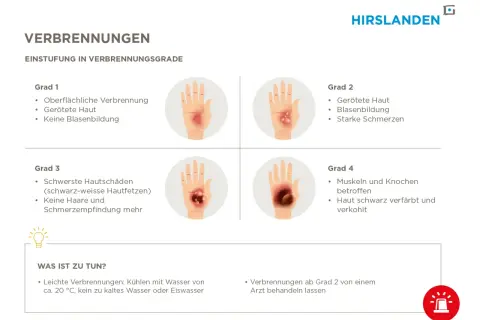 Verbrühungen werden nach ihrem **Verbrennung grad** eingestuft: Grad 1 (gerötete Haut), Grad 2 (Blasenbildung), Grad 3 (Hautfetzen) und Grad 4 (verkohlte Haut).