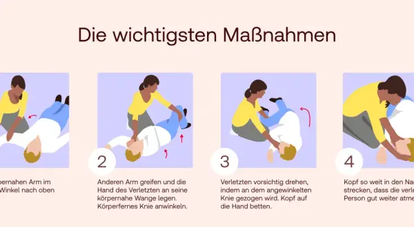 Schritt-für-Schritt-Anleitung, wie man eine Person in die stabile Seitenlage bringt, um sicherzustellen, dass sie atmen kann. Dies ist ein wichtiger Schritt, wenn man wissen muss, was ist reanimieren.