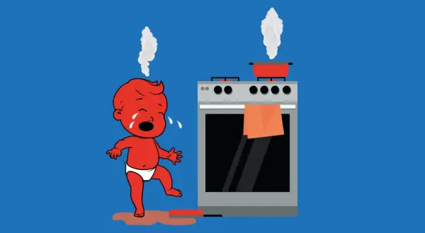 Ein weinendes Baby mit Dampf auf dem Kopf steht neben einem Herd. Ein roter Topf dampft. Dies ist eine Darstellung einer schweren Verbrennung 4. Grades.