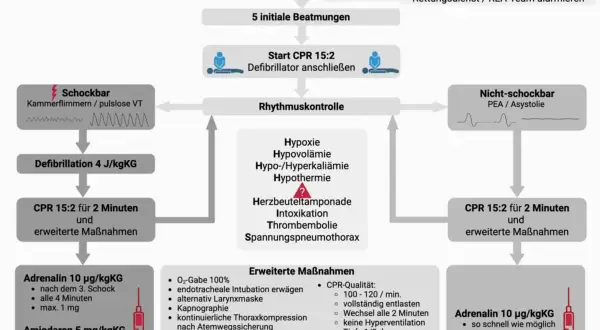 Schockbarer Rhythmus (Kammerflimmern/pulslose VT) erfordert Defibrillation und CPR 15:2. Nicht-schockbarer Rhythmus (PEA/Asystolie) erfordert CPR 15:2.