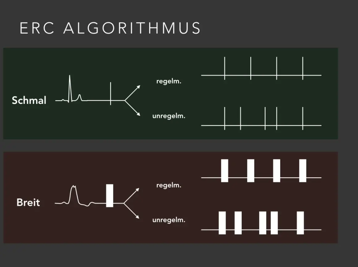 ERC Algorithmus: Schmale und breite QRS-Komplexe, die zu regelmäßigen oder unregelmäßigen Rhythmen führen. Diese Unterscheidung ist wichtig für die Behandlung von nicht defibrillierbare Rhythmen.