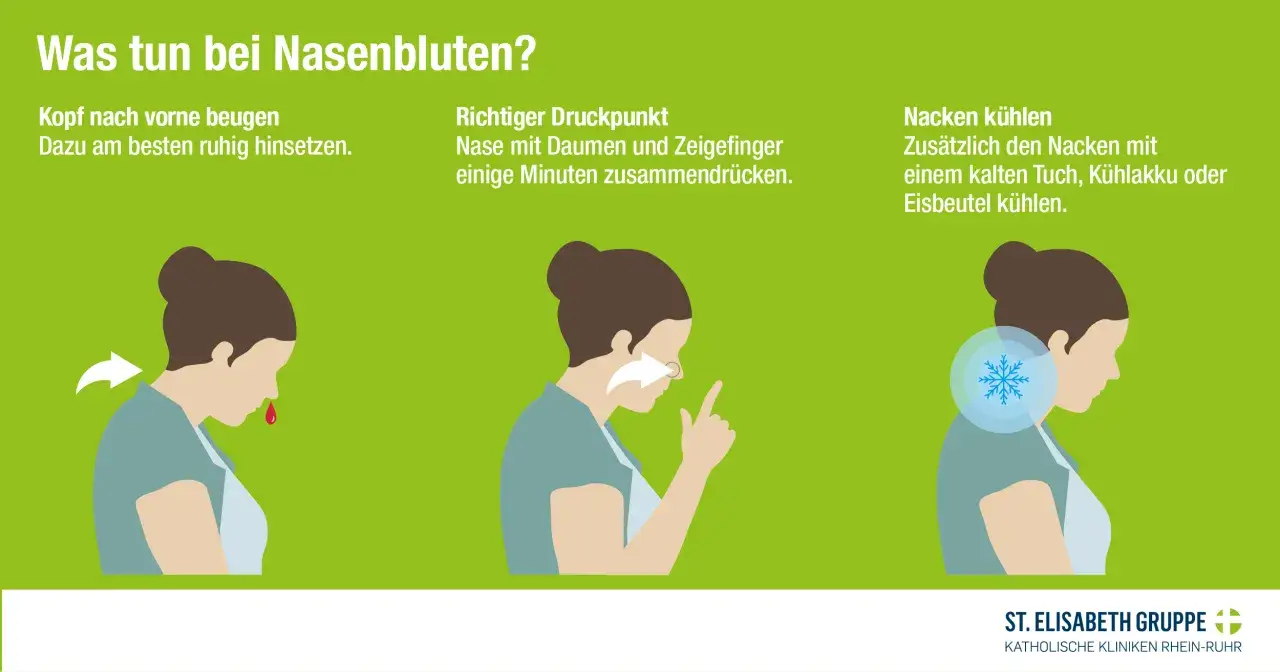 Kopf nach vorne beugen, Nase mit Daumen und Zeigefinger zusammendr&uuml;cken, Nacken k&uuml;hlen. So l&auml;sst sich starkes Nasenbluten stoppen.